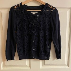 Abercrombie Lace Cardigan